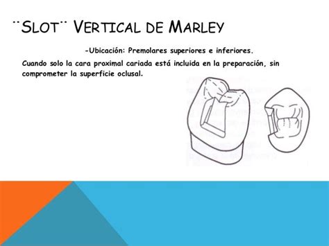 slot vertical de markley